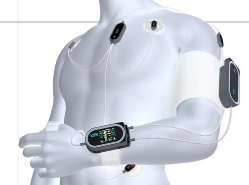ʵ顷۲Sotera Wireless˾Visi Mobileƽ̨ΪһҽԺеļ⹦
